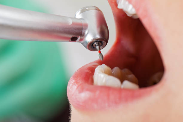 Best Cracked Tooth Emergency Dentist  in Chowchilla, CA